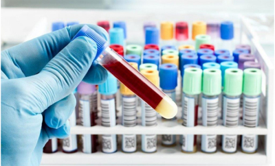 Лаборатория тестирования крови (блок диагностики трансфузионных инфекций)